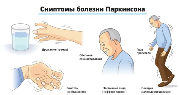 Болезнь Паркинсона Фото - 3